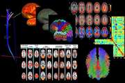 New services will be provided for researchers of the country in the area of brain image processing. 