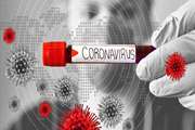 Mass Production of Native Coronavirus Detection Kits: Soon/Research to Produce Corona Vaccine at Iran University of Medical Sciences