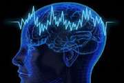 Manufacturing of a device for deep brain excitation by researchers of Iran